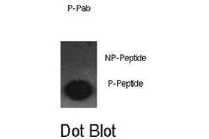 Dot blot analysis of JUN (phospho S63) polyclonal antibody  on nitrocellulose membrane. (C-JUN Antikörper  (pSer63))