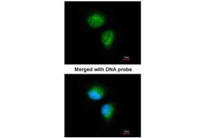 Immunofluorescence (IF) image for anti-Methylmalonic Aciduria (Cobalamin Deficiency) CblC Type, with Homocystinuria (MMACHC) (Center) antibody (ABIN2856443)
