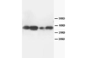 Western Blotting (WB) image for anti-Tumor Necrosis Factor, alpha-Induced Protein 1 (Endothelial) (TNFAIP1) (N-Term) antibody (ABIN1109277)