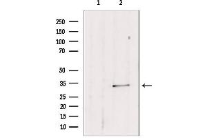 Western blot analysis of extracts from mouse lung, using SULT1E1 antibody.