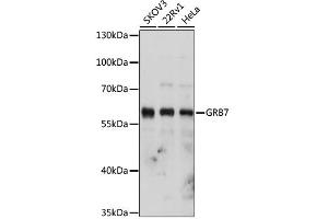 Western blot analysis of extracts of various cell lines, using GRB7 antibody. (GRB7 Antikörper)