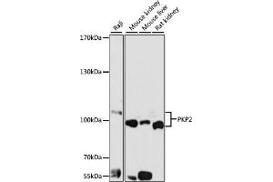 Western blot analysis of extracts of various cell lines, using PKP2 antibody (ABIN6128554, ABIN6145717, ABIN6145718 and ABIN6221177) at 1:1000 dilution. (Plakophilin 2 Antikörper  (AA 578-837))