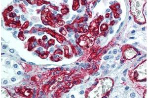 Human Kidney, Endothelium (formalin-fixed, paraffin-embedded) stained with CD34 antibody ABIN305772 at 5 ug/ml followed by biotinylated anti-mouse IgG secondary antibody ABIN481714, alkaline phosphatase-streptavidin and chromogen.