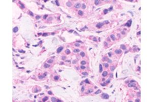 Immunohistochemistry (IHC) image for anti-Cadherin EGF LAG Seven Pass G-Type Receptor 2 (CELSR2) (C-Term) antibody (ABIN1048432)