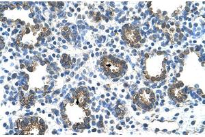 Human Lung (Glucuronidase beta Antikörper  (C-Term))