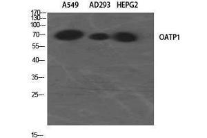 Western Blotting (WB) image for anti-Solute Carrier Organic Anion Transporter Family, Member 1A2 (SLCO1A2) (Internal Region) antibody (ABIN3185985) (SLCO1A2 Antikörper  (Internal Region))