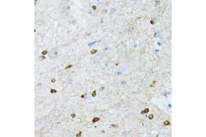 Immunohistochemistry of paraffin-embedded mouse spinal cord using ROCK2 antibody (ABIN5973333) at dilution of 1/100 (40x lens). (ROCK2 Antikörper)