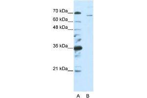 Western Blotting (WB) image for anti-Splicing Factor 1 (SF1) (C-Term) antibody (ABIN2776689)