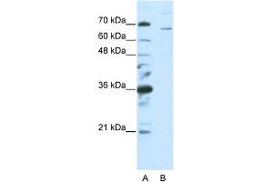 WB Suggested Anti-SF1  Antibody Titration: 0. (Splicing Factor 1 Antikörper  (C-Term))