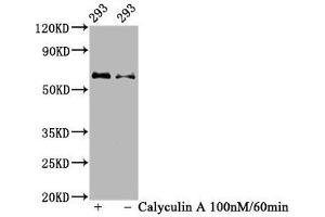 Western Blot Positive WB detected in 293 whole cell lysate(treated with Calyculin A or not) All lanes Phospho-AKT1 antibody at 1. (Rekombinanter AKT1 Antikörper  (pSer473))