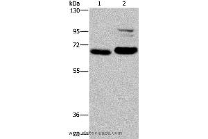 Western blot analysis of K562 and NIH/3T3 cell, using OS9 Polyclonal Antibody at dilution of 1:200 (OS9 Antikörper)