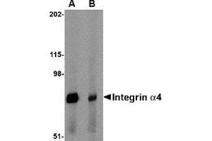 Western blot analysis of Integrin alpha 4 in rat spleen tissue lysate with Integrin alpha 4 antibody at 1 μg/ml in (A) the absence and (B) the presence of blocking peptide.