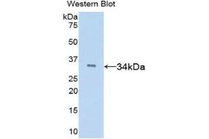 Western Blotting (WB) image for anti-Tissue Factor Pathway Inhibitor (Lipoprotein-Associated Coagulation Inhibitor) (TFPI) (AA 29-302) antibody (ABIN1078584)