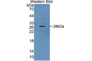 Western blot analysis of the recombinant protein. (CAMLG Antikörper  (AA 1-187))