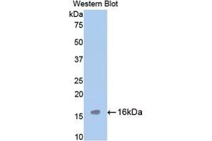 Western blot analysis of the recombinant protein. (TPSAB1 Antikörper  (AA 149-273))