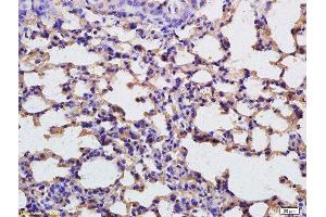 Immunohistochemistry (Paraffin-embedded Sections) (IHC (p)) image for anti-Fructose-1,6-Bisphosphatase 1 (FBP1) (AA 31-130) antibody (ABIN752053)