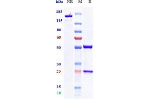 Anti-TIGIT Reference Antibody (vibostolimab) on SDS-PAGE under reducing (R) condition. (Rekombinanter TIGIT (Vibostolimab Biosimilar) Antikörper)