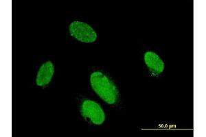 Immunofluorescence of monoclonal antibody to PITX2 on HeLa cell. (PITX2 Antikörper  (AA 1-324))