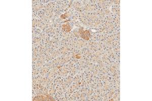 Immunohistochemistry (Paraffin-embedded Sections) (IHC (p)) image for anti-Secreted Frizzled-Related Protein 5 (SFRP5) (AA 190-219) antibody (ABIN656890)
