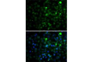 Immunofluorescence analysis of A-549 cells using SMYD4 antibody (ABIN6133038, ABIN6148171, ABIN6148172 and ABIN6223147). (SMYD4 Antikörper  (AA 1-260))