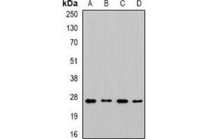 Western blot analysis of CHMP1B expression in MCF7 (A), SKOV3 (B), mouse liver (C), mouse brain (D) whole cell lysates. (CHMP1B Antikörper)