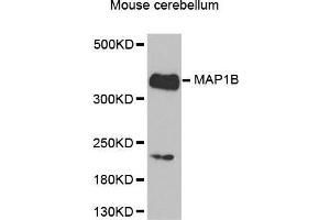 Western Blotting (WB) image for anti-Microtubule-Associated Protein 1B (MAP1B) (AA 1820-2100) antibody (ABIN6220205) (MAP1B Antikörper  (AA 1820-2100))