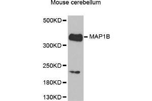 MAP1B Antikörper  (AA 1820-2100)
