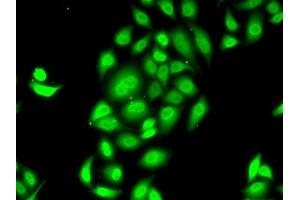 Immunofluorescence analysis of MCF7 cells using SPDEF antibody (ABIN6132572, ABIN6148332, ABIN6148334 and ABIN6218364). (SPDEF/PSE Antikörper  (AA 1-335))