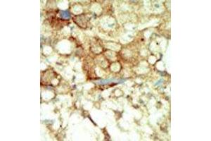 Image no. 2 for anti-Ret Proto-Oncogene (RET) (C-Term) antibody (ABIN359927) (Ret Proto-Oncogene Antikörper  (C-Term))
