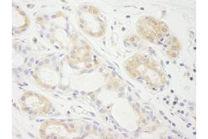 Immunohistochemistry (IHC) image for anti-Eukaryotic Translation Initiation Factor 2A, 65kDa (EIF2A) (AA 525-575) antibody (ABIN7448543)
