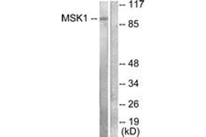 Western blot analysis of extracts from 293 cells, treated with UV 15', using MSK1 (Ab-581) Antibody.