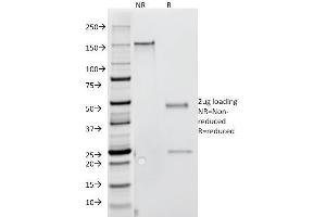 SDS-PAGE Analysis Purified IFNG Mouse Monoclonal Antibody (G-23). (Interferon gamma Antikörper)
