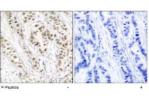 Image no. 1 for anti-Breast Cancer 1 (BRCA1) (pSer1524) antibody (ABIN196816) (BRCA1 Antikörper  (pSer1524))