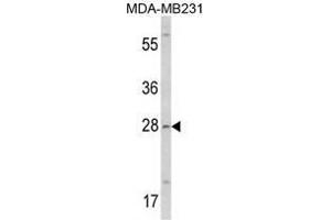 Image no. 1 for anti-Collectin Sub-Family Member 11 (COLEC11) (N-Term) antibody (ABIN452858) (COLEC11 Antikörper  (N-Term))