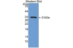 Western blot analysis of the recombinant protein. (IL7R Antikörper  (AA 1-239))