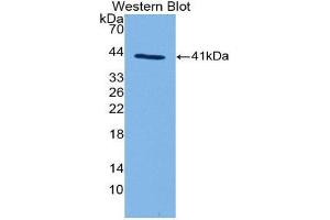 Western Blotting (WB) image for anti-Complement Fragment 3a (C3a) (AA 670-742) antibody (ABIN3208725) (C3a Antikörper  (AA 670-742))