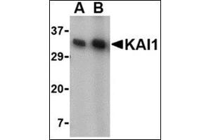 Western blot analysis of KAI1 in A549 cell lysate with this product at (A) 0.