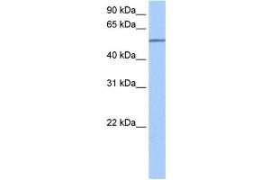 SEMA6D antibody used at 0. (SEMA6D Antikörper  (N-Term))