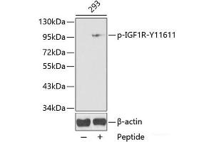 Western blot analysis of extracts from 293 cells using Phospho-IGF1R(Y1161) Polyclonal Antibody. (IGF1R Antikörper  (pTyr1161))