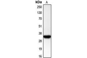 Western blot analysis of CDK2 expression in Jurkat (A) whole cell lysates. (CDK2 Antikörper  (C-Term))