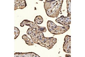 IHC analysis of SNRPA1 using anti-SNRPA1 antibody (ABIN7599131). (SNRPA1 Antikörper  (AA 1-233))
