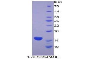 SDS-PAGE (SDS) image for Keratin 1 (KRT1) (AA 487-644) protein (His tag) (ABIN1980749)