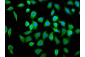 Immunofluorescence (IF) image for anti-Eukaryotic Translation Initiation Factor 4A2 (EIF4A2) (AA 1-407) antibody (ABIN7152106)