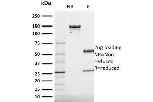SDS-PAGE (SDS) image for anti-Keratin 20 (KRT20) (AA 196-323) antibody (ABIN6940346)