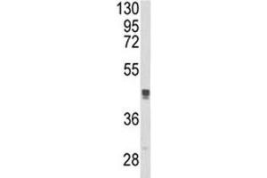 Western blot analysis of TGN46 antibody and MCF-7 lysate.