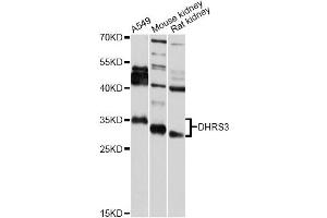 Western blot analysis of extracts of various cell lines, using DHRS3 antibody (ABIN5975596) at 1/2000 dilution. (DHRS3 Antikörper)