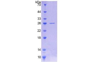 SDS-PAGE analysis of Human POMT1 Protein. (POMT1 Protein)