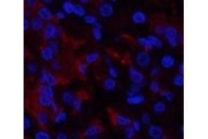 Immunofluorescence analysis of Human stomach tissue using RUNX2 Polyclonal Antibody at dilution of 1:200. (RUNX2 Antikörper)
