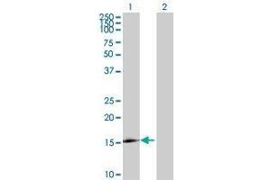 Western Blotting (WB) image for LOC124220 293T Cell Transient Overexpression Lysate(Denatured) (ABIN1338620)