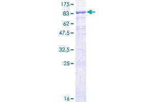 Image no. 1 for Interferon alpha/beta Receptor 1 (IFNAR1) (AA 1-557) protein (GST tag) (ABIN1307486) (IFNAR1 Protein (AA 1-557) (GST tag))